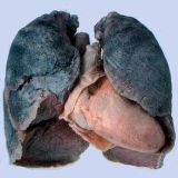 Argentina y Venezuela, los más fumadores de Latam