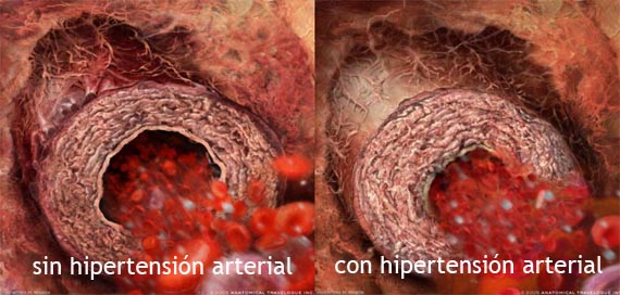 arterias.jpg arterias.jpg