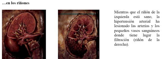 rinones.jpg rinones.jpg