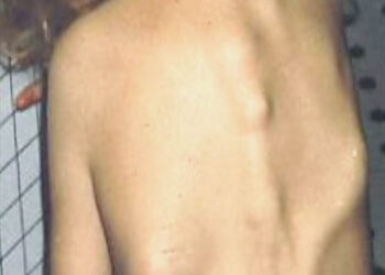 NocheTemtica_espalda