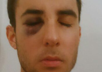 ONDA ARCOIRIS Hablamos con el joven agredido en Málaga por un guarda de seguridad homófobo