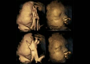 feto mujer embarazada fumadora