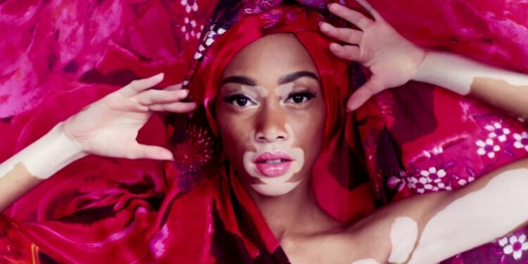 Winnie Harlow, la primera modelo con vitíligo, en una imagen de archivo.