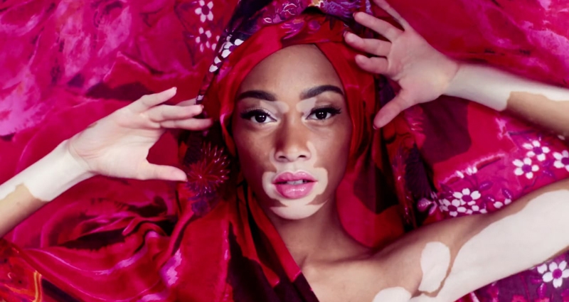 Winnie Harlow, la primera modelo con vitíligo, en una imagen de archivo.