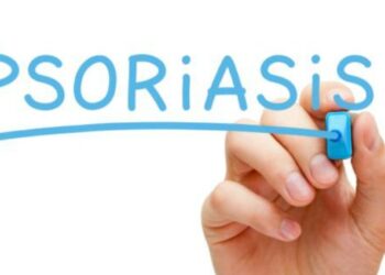 tratamiento biológico en psoriasis