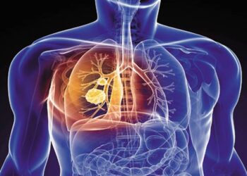 En 2030, la EPOC será la tercera causa de muerte por detrás del cáncer de pulmón y la diabetes