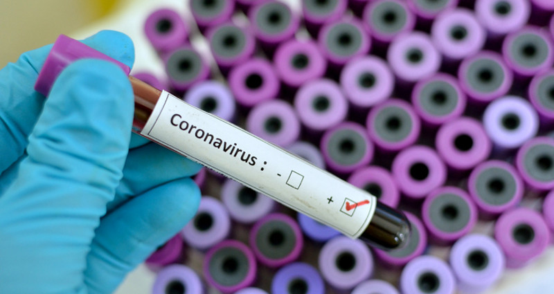 Coronavirus.jpg