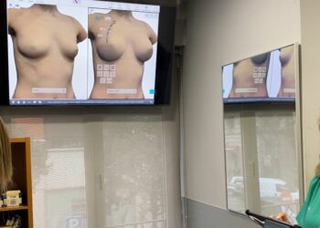 Aumento de mamas: consideraciones a tener en cuenta antes de someterse a esta cirugía