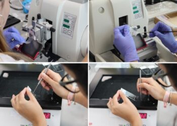 El Departamento de Anatomía Patológica de los Hospitales Públicos gestionados por Quirónsalud en Madrid consolida su proyecto de digitalización