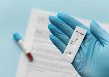 ¿Qué tipo de test COVID-19 podemos adquirir en las farmacias sin necesidad de receta?