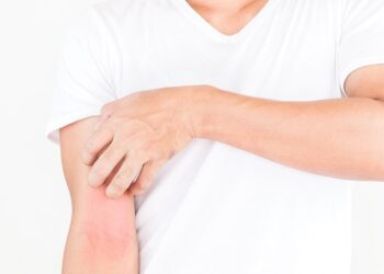 Día Mundial de la Dermatitis Atópica