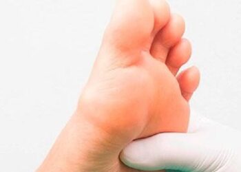 Las personas que sufren diabetes tienen mayor riesgo de sufrir problemas en los pies