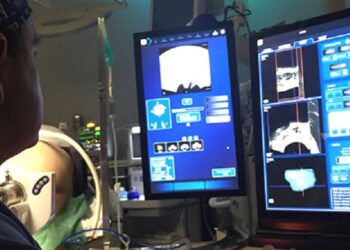 La terapia focal, el tratamiento que elimina el cáncer de próstata localizado sin comprometer la función prostática