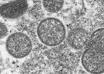 La OMS eleva a 131 los casos de viruela del mono, un tercio de ellos en España