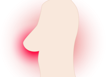 ¿Cuáles son los peligros que supone padecer cáncer de mama y diabetes?