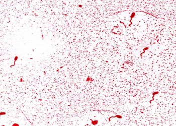 Sanidad precisa que el caso de la finca de Toledo no es cólera sino gastroenteritis