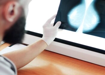 La mamografía con contraste o la RM están generando resultados muy prometedores