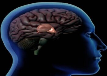 Avances en la extirpación de tumores pineales con técnicas microquirúrgicas