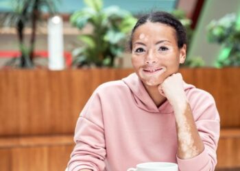 Nuevos horizontes terapéuticos para la enfermedad del vitíligo