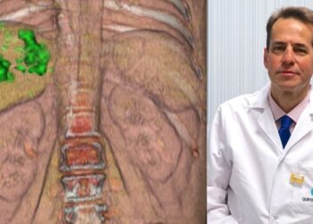 Nuevas dianas terapéuticas de teragnosis radiometabólica