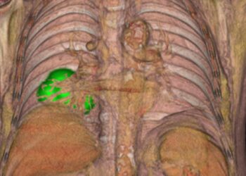 El Hospital Universitario La Luz incorpora nuevos biomarcadores de imagen PET-CT