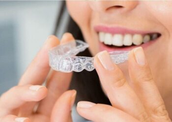 ¿Pensabas comprar alineadores dentales por Internet? No lo hagas