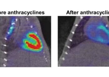 Dianas terapéuticas para prevenir el daño cardiaco asociado a una terapia para el cáncer