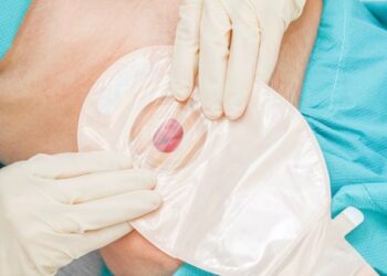 Nueva unidad de heridas complejas y estomaterapia en el Hospital La Luz