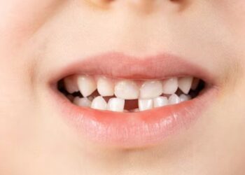 Los dientes de leche podrían ayudar en el desarrollo de terapias para enfermedades raras