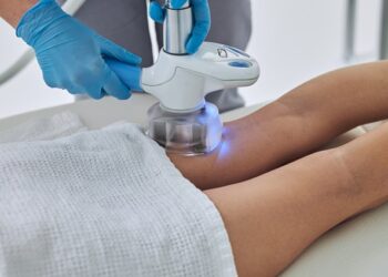 El Hospital General de Villalba consolida su experiencia en el tratamiento de varices mediante termoablación