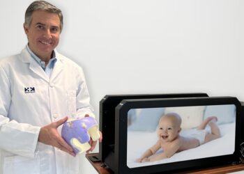 HM Hospitales adquiere un escáner para corregir deformidades craneales en bebés