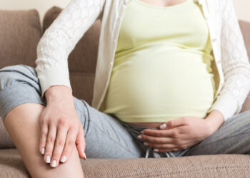 Varices en el embarazo, una afección frecuente que requiere atención especializada