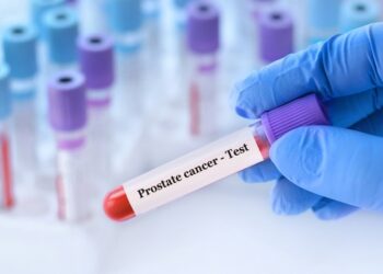 Dolor óseo en varones mayores: la señal silenciosa del cáncer de próstata metastásico