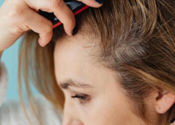 El sol y el cloro dañan el cuero cabelludo y aceleran la caída por rotura