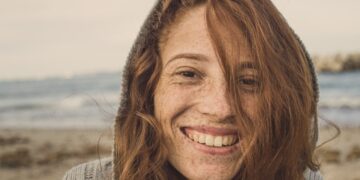 Pecas, una moda peligrosa para la piel