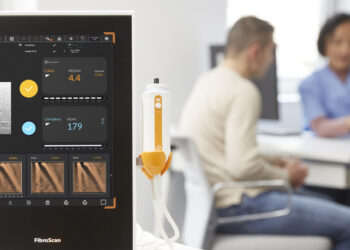 Ruber Internacional Centro Médico Habana incorpora una tecnología no invasiva para detectar fibrosis y grasa en el hígado