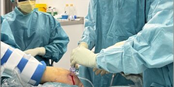 Un estudio clínico demuestra los beneficios de un diseño específico de prótesis reversa de hombro en fracturas complejas del húmero