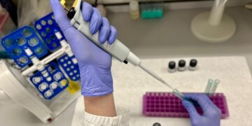 La citometría de flujo abre nuevas vías para el diagnóstico precoz de la enfermedad celíaca