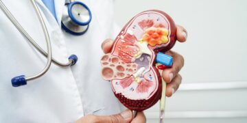 Los Hospitales de Quirónsalud integrados en el Sermas detectaron 424 nuevos casos de enfermedad renal crónica en 2025