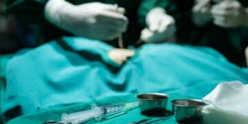 Cuando está indicada la circuncisión en adultos y qué beneficios tiene para la salud