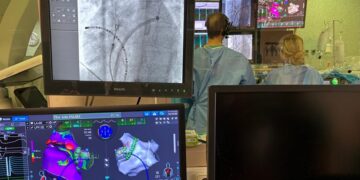 HM CIEC incorpora una nueva tecnología de ablación cardíaca que mejora la precisión y la seguridad