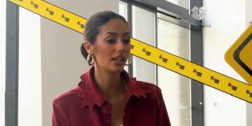 Botox en TV y el debate sobre la presión estética en los medios