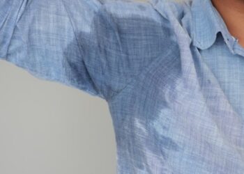 La hiperhidrosis axilar puede reducirse hasta en un 70%