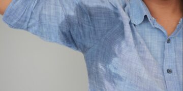 La hiperhidrosis axilar puede reducirse hasta en un 70%