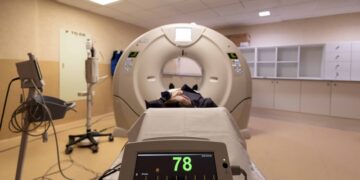 HM CIEC incorpora una tecnología pionera para identificar qué pacientes necesitan una intervención coronaria