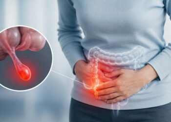 Dolor abdominal que va a más: cuándo puede ser apendicitis