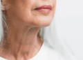 Cuello y escote: las grandes olvidadas del cuidado facial