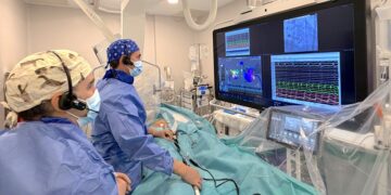 Tecnología avanzada para la ablación de fibrilación auricular y arritmias complejas