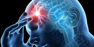 La atención personalizada y los nuevos tratamientos para la migraña mejoran la calidad de vida