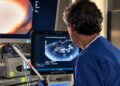 Una técnica mínimamente invasiva permite destruir un tumor de páncreas